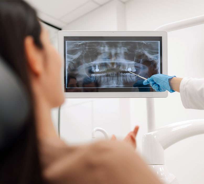 Guided Dental Implants